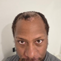 <em><strong>Marcus L</strong></em>